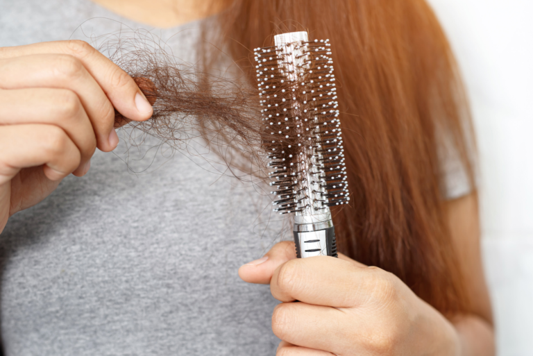 Alopecie femme