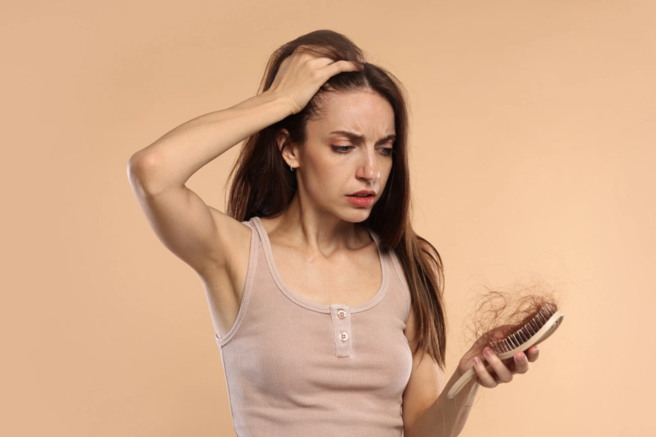 alopecie femme